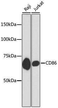 CD86 Rabbit mAb