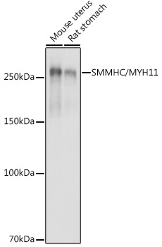 SMMHC/MYH11 Rabbit pAb