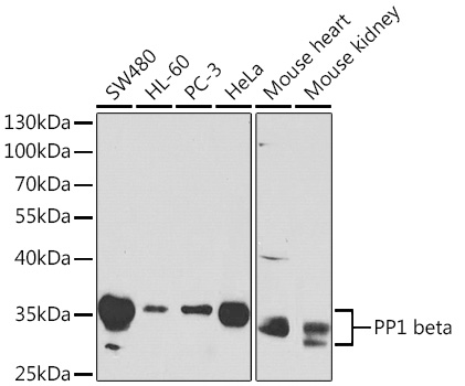 PP1 beta Rabbit pAb