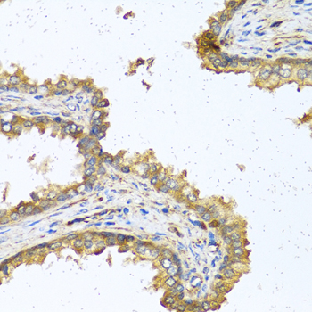 RNASE11 Rabbit pAb