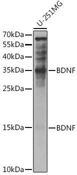 BDNF Rabbit pAb