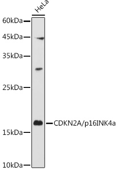 [KO Validated] CDKN2A/p16INK4a Rabbit pAb