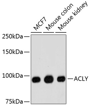 ACLY Rabbit mAb