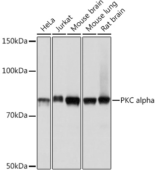 PKC alpha Rabbit mAb