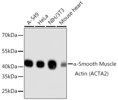 _-Smooth Muscle Actin (ACTA2) Rabbit mAb