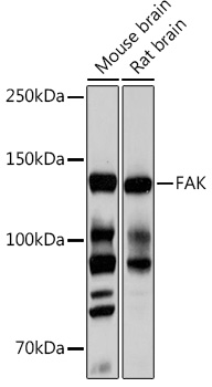 FAK Rabbit mAb