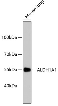 ALDH1A1 Rabbit mAb
