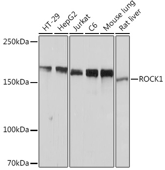 ROCK1 Rabbit mAb