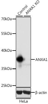 [KO Validated] ANXA1 Rabbit pAb