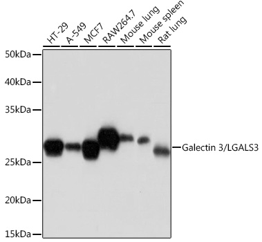 Galectin 3/LGALS3 Rabbit mAb