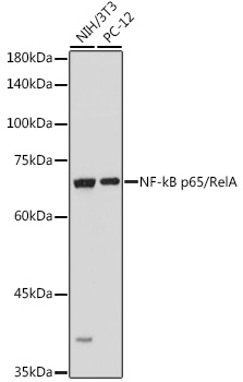 NF-kB p65/RelA Rabbit pAb