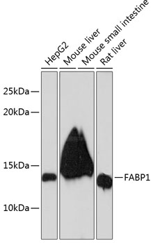 FABP1 Rabbit mAb