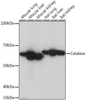 Catalase Rabbit mAb