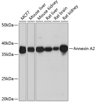 Annexin A2 Rabbit mAb