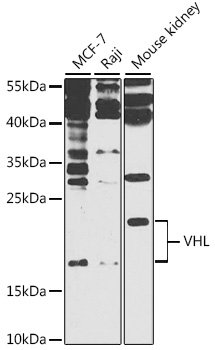 VHL Rabbit pAb