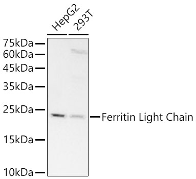 Ferritin Light Chain Rabbit mAb