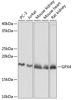 [KD Validated] GPX4 Rabbit mAb