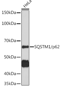 SQSTM1/p62 Rabbit pAb