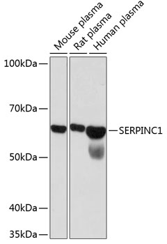 SERPINC1 Rabbit mAb