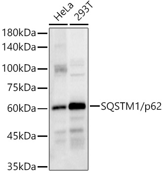 [KO Validated] SQSTM1/p62 Rabbit pAb