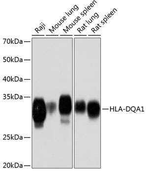 HLA-DQA1 Rabbit mAb
