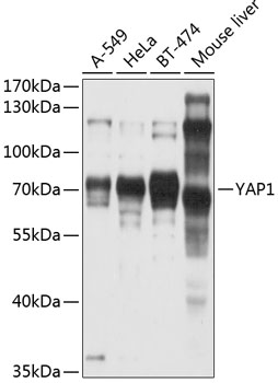 [KO Validated] YAP1 Rabbit pAb