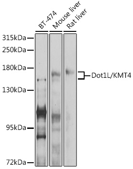 Dot1L/KMT4 Rabbit pAb