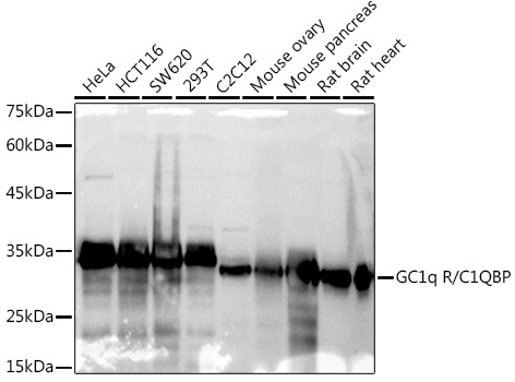 GC1q R/C1QBP Rabbit mAb