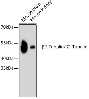 _II-Tubulin/_2-Tubulin Rabbit mAb