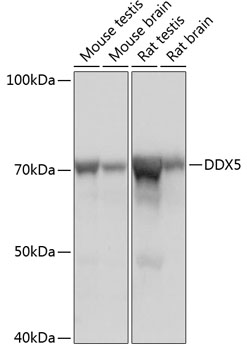 DDX5 Rabbit mAb