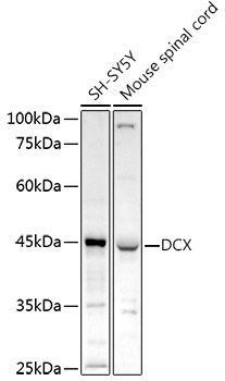 Doublecortin Rabbit pAb