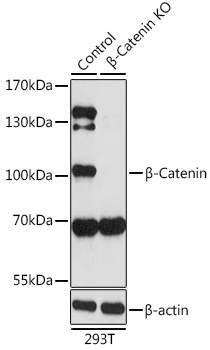 [KO Validated] _-Catenin Rabbit pAb