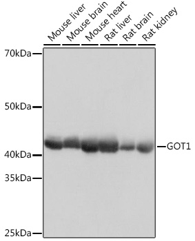 GOT1 Rabbit mAb