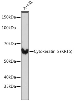 Cytokeratin 5 (KRT5) Rabbit mAb