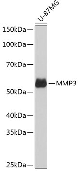 MMP3 Rabbit mAb