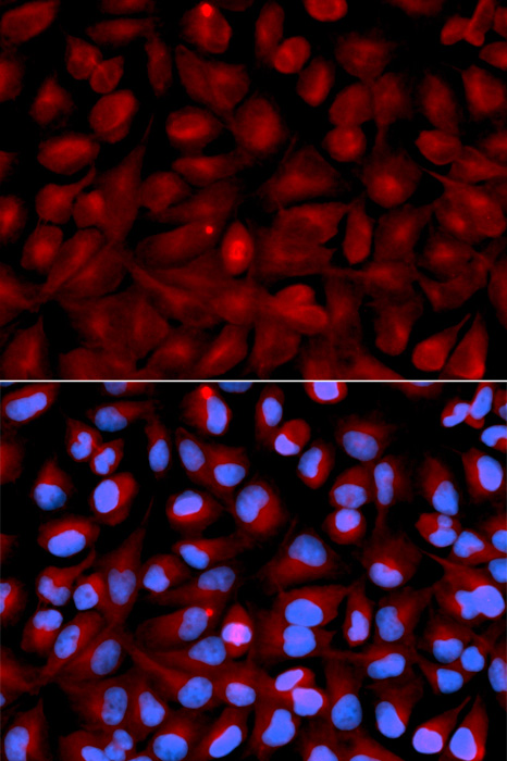 HDAC6 Rabbit pAb