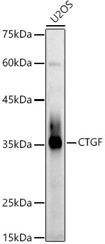 CTGF Rabbit pAb