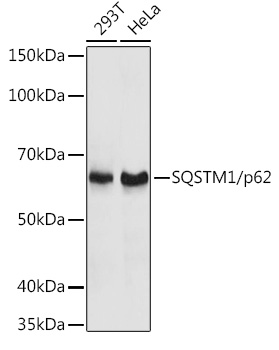 SQSTM1/p62 Rabbit pAb