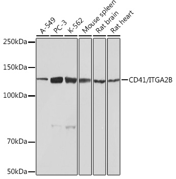 CD41/ITGA2B Rabbit mAb