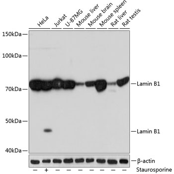 Lamin B1 Rabbit mAb