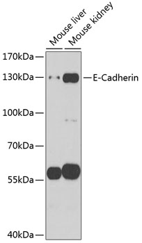 E-Cadherin Rabbit pAb
