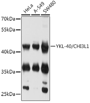 YKL-40/CHI3L1 Rabbit pAb