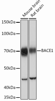 BACE1 Rabbit mAb