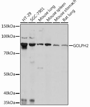GOLPH2 Rabbit mAb