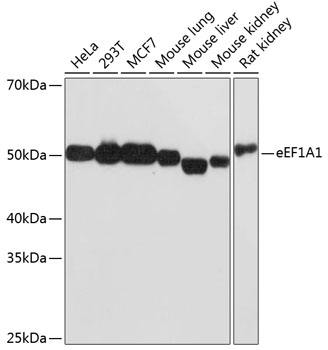 eEF1A1 Rabbit mAb