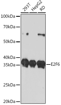 E2F6 Rabbit mAb