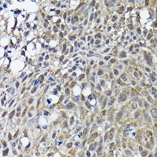 BRCA1 Rabbit pAb