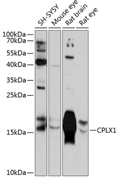 CPLX1 Rabbit pAb
