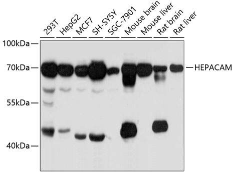 HEPACAM Rabbit pAb