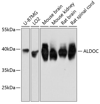 ALDOC Rabbit pAb